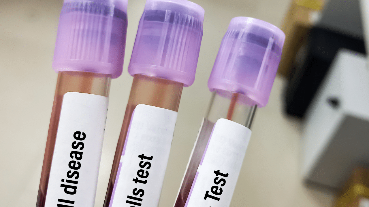 Cracking The Code What Blood Tests Can And Can T Tell You About Your