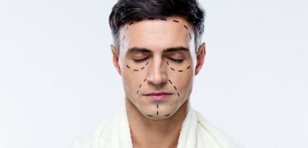 a man with dotted lines on his face