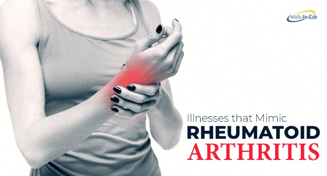 Illnesses that Mimic Rheumatoid Arthritis - Walkin Lab