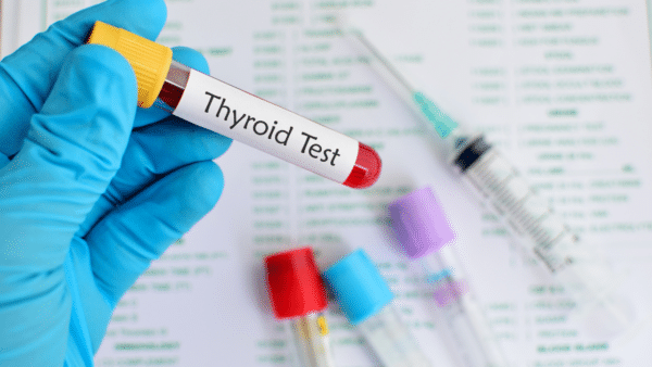 thyroid tests