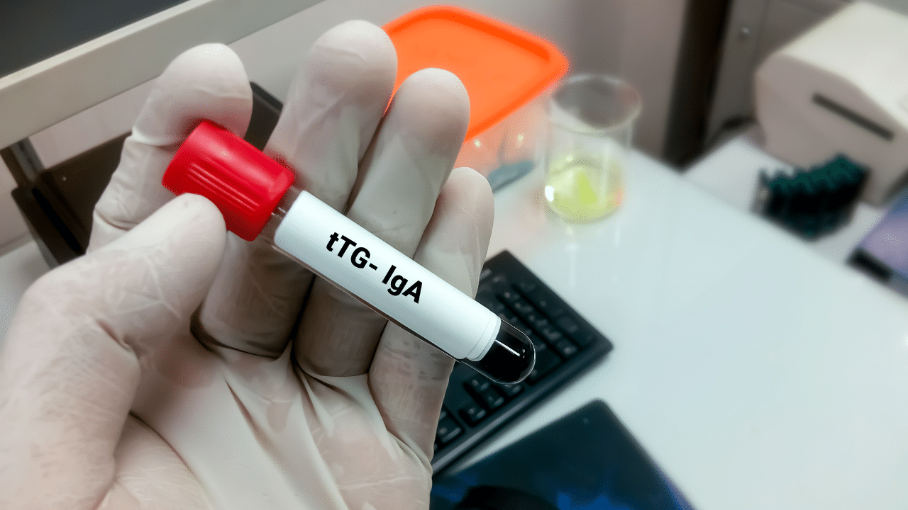 Understanding the Tissue Transglutaminase (tTG) Blood Test for Celiac ...