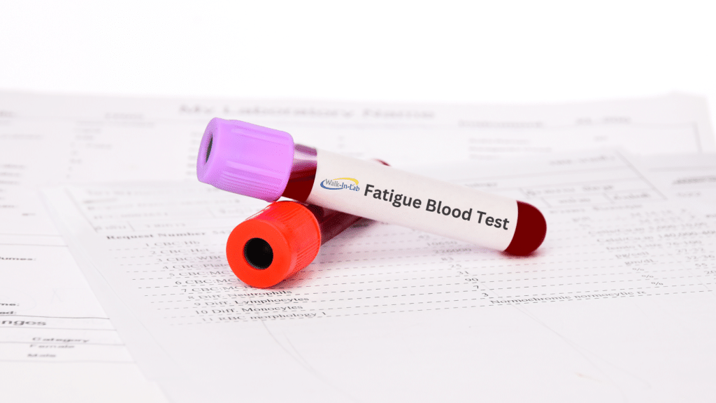 Fatigue Blood Tests